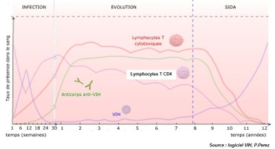 infection-VIH