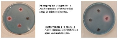 Antibiogrammes réalisés.JPG