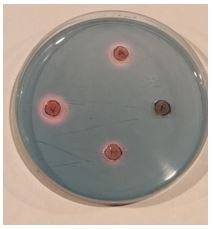 Photo antibiogramme.JPG