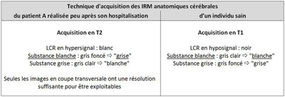 Acquisition T1 T2.JPG