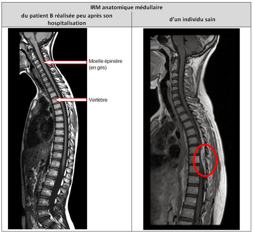 Capture ecran production patient B.JPG