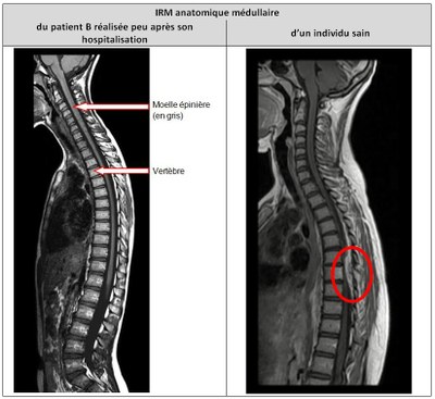 Capture ecran production patient B.JPG