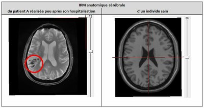 Capture production partie 1 TP motricite.JPG