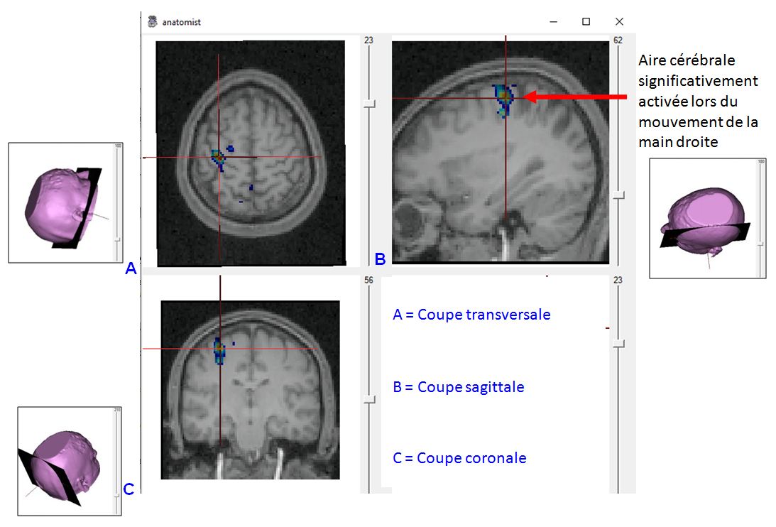 Production bouger main droite.JPG