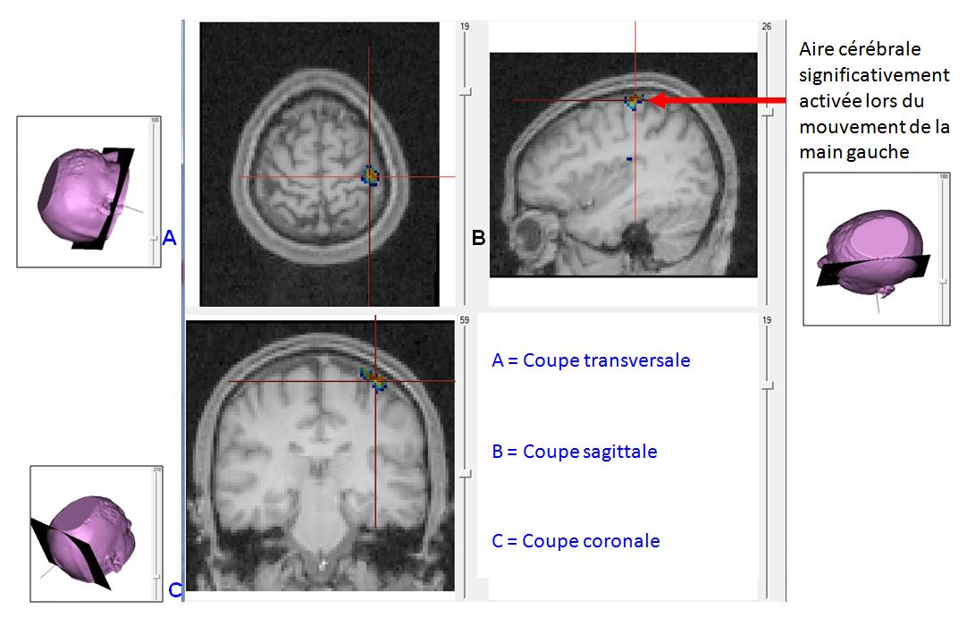 Production bouger main gauche.JPG