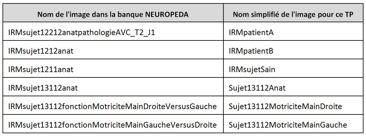 Tableau correspondance IRM renommees et IRM NeuroPeda.JPG