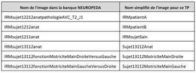 Tableau correspondance IRM renommees et IRM NeuroPeda.JPG