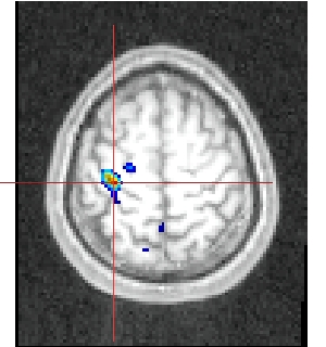 13112axialmaindroiteversusmaingauche