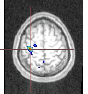 13112axialmaindroiteversusmaingauche