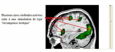 Production attendue activité 1