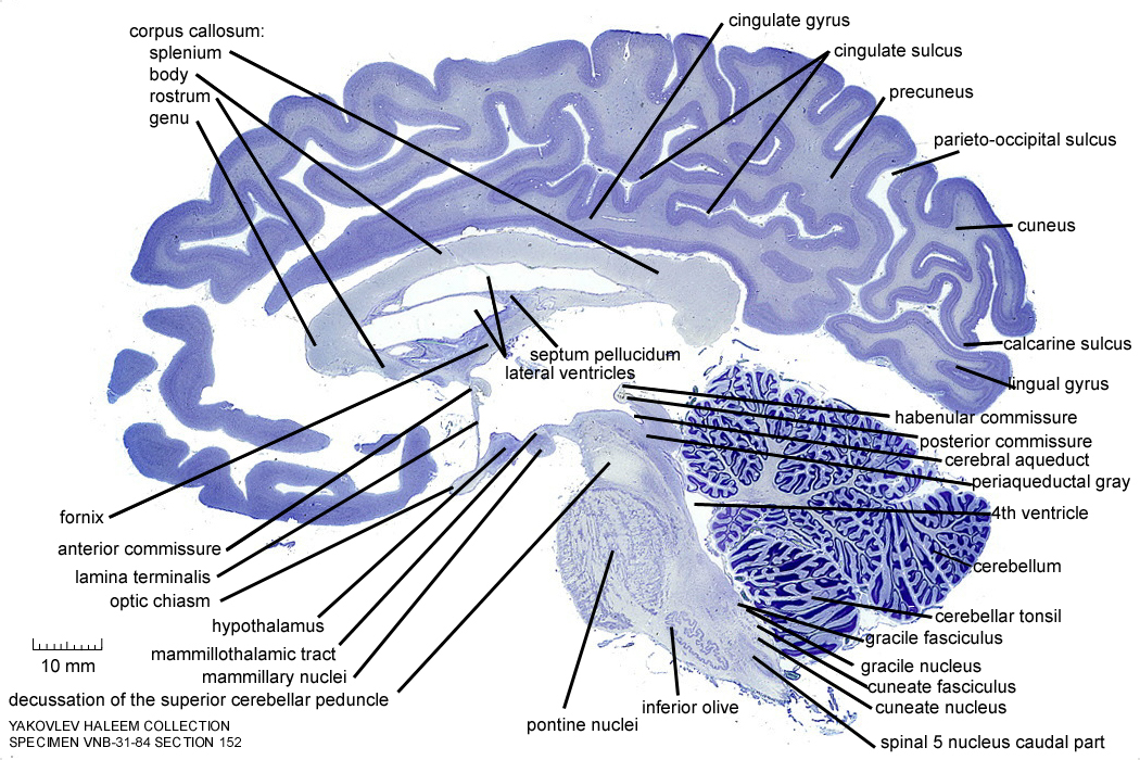 0152gyrus cingulatumsagi.jpg