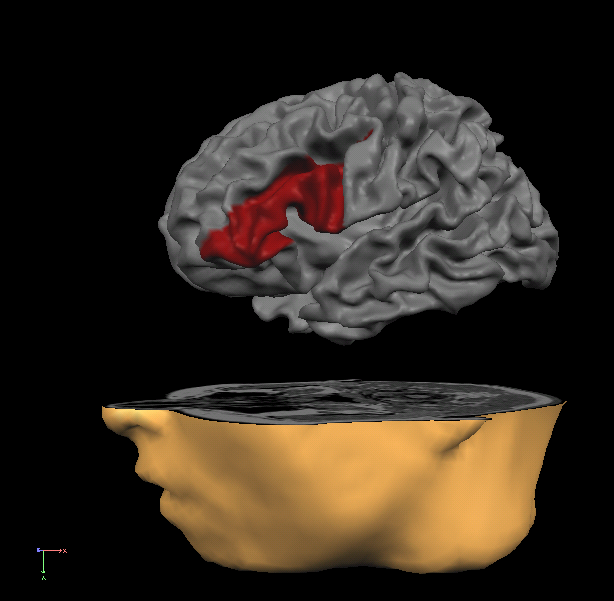 gyrus frontal inferieur gauche.png