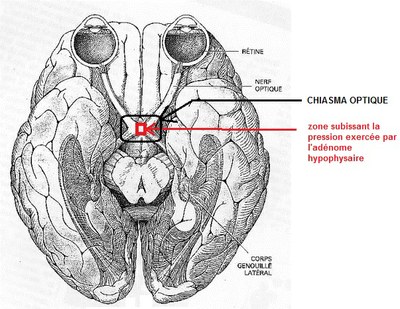 chiasma_optique_madameZ