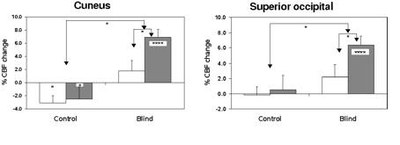 activation cuneus.JPG