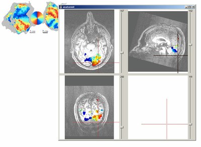 Ecran imgae 131311 et stimulus