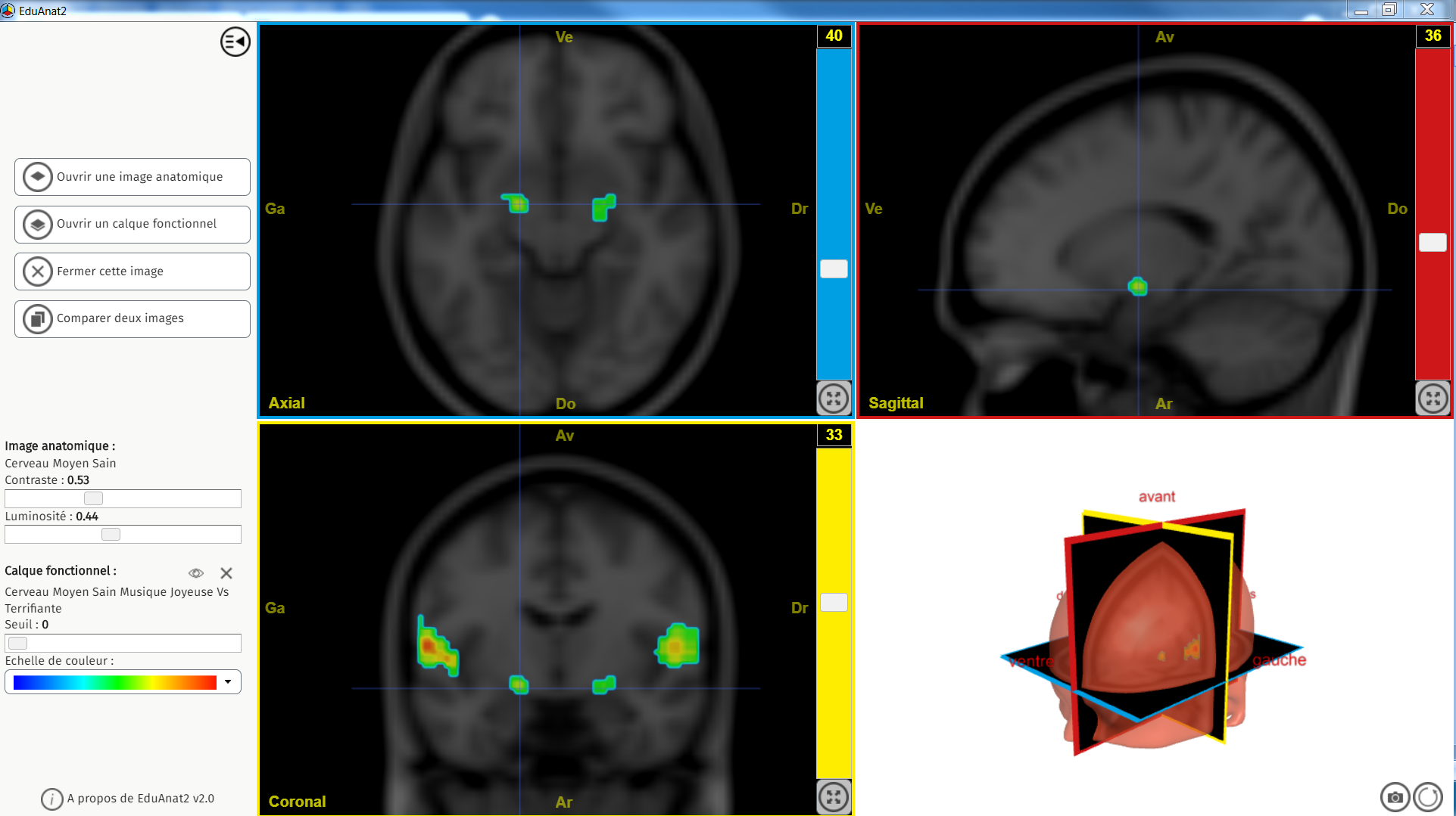 Stress Juoeyx versus terrifiant