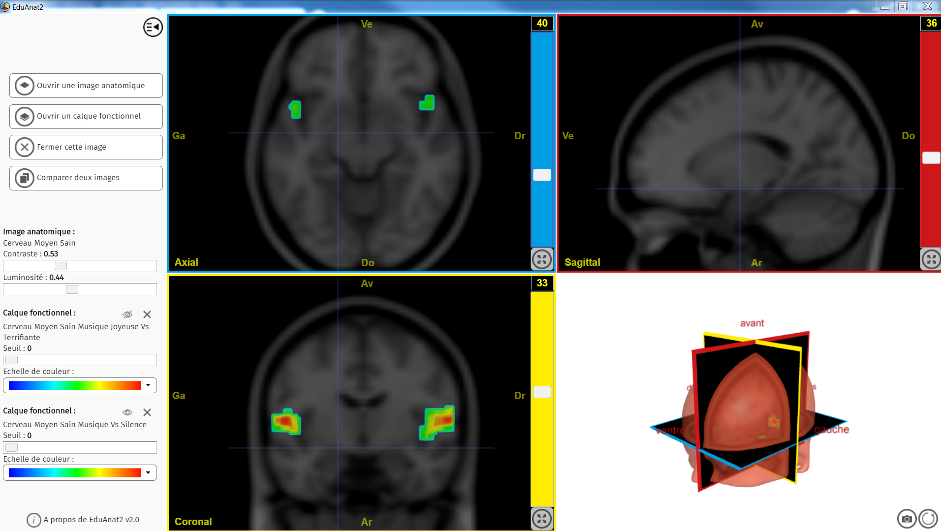 Stress musique versus silence