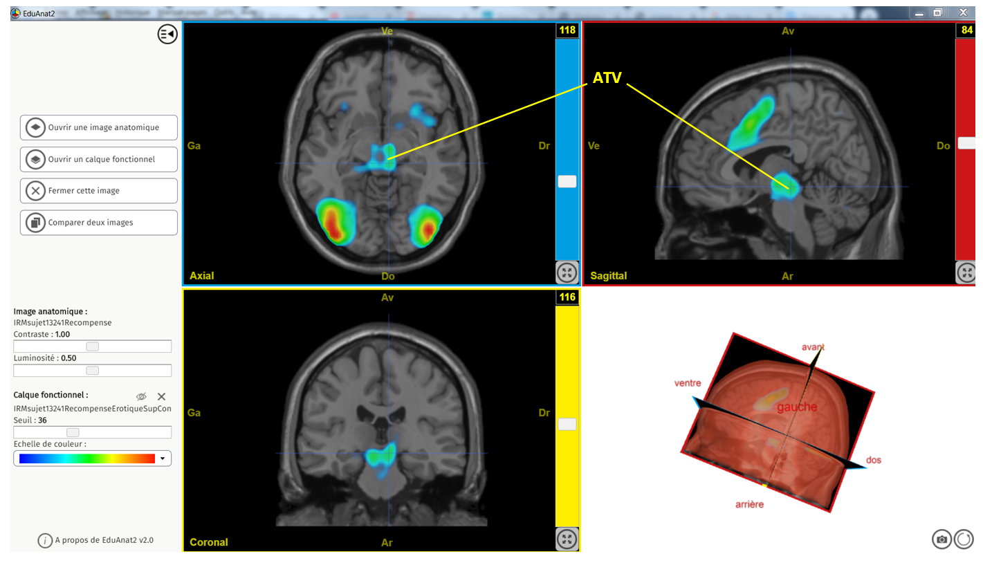 ATV legendée erotique sup controle 