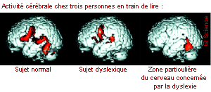 Activité cérébrale
