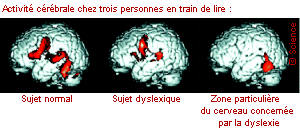 activite cerebral
