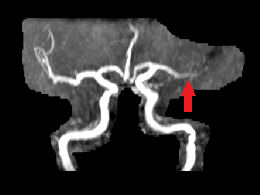 Sujet12212_ARMfleche_J1