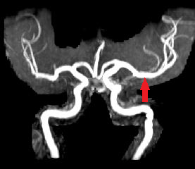Sujet12212_ARMfleche_2H