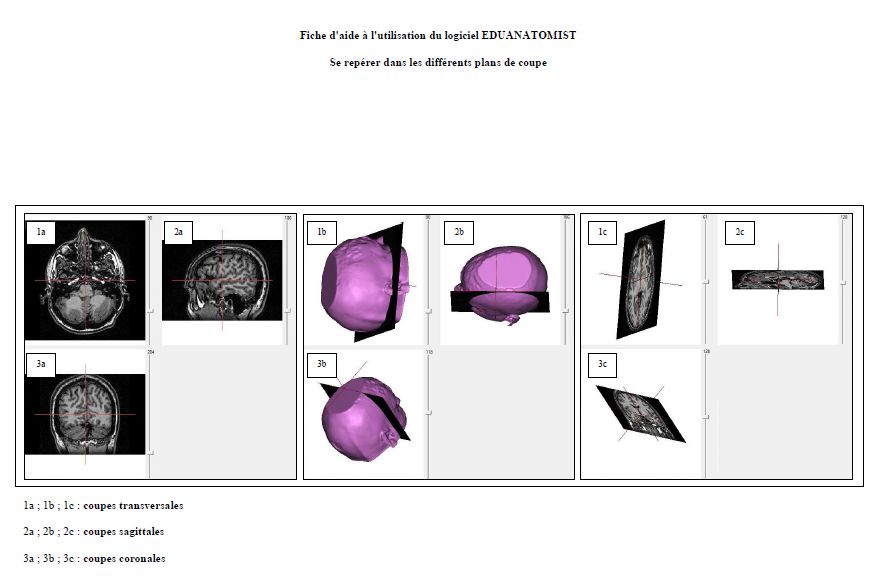 Fiche technique de visualisation 1
