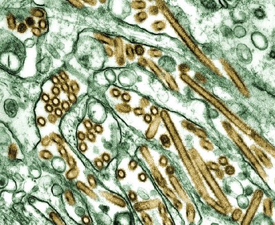 Colorized_transmission_electron_micrograph_of_Avian_influenza_A_H5N1_viruses.jpg